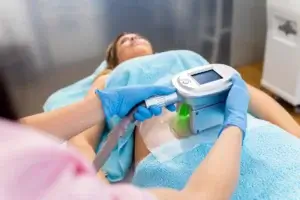 CoolSculpting Treatment